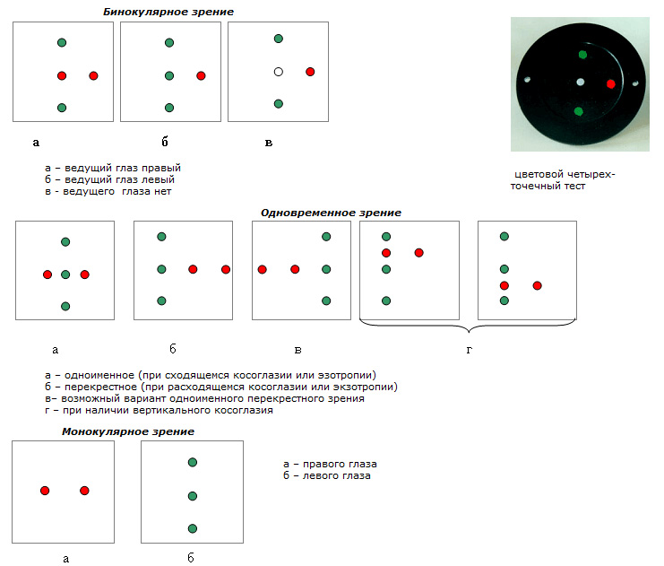 Нарушение бинокулярного зрения в результате которого происходит раздвоение изображения